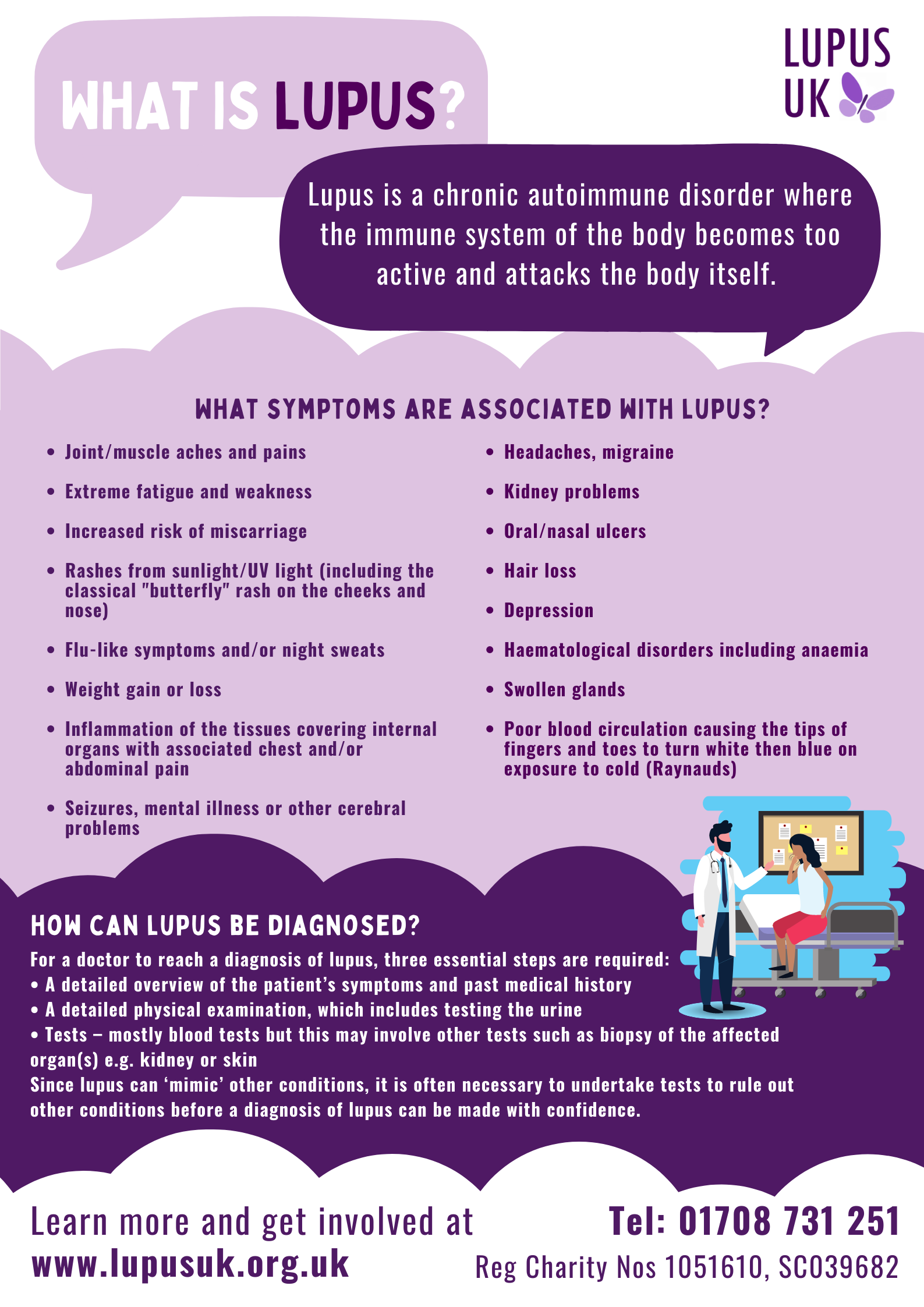 What is sales lupus nhs
